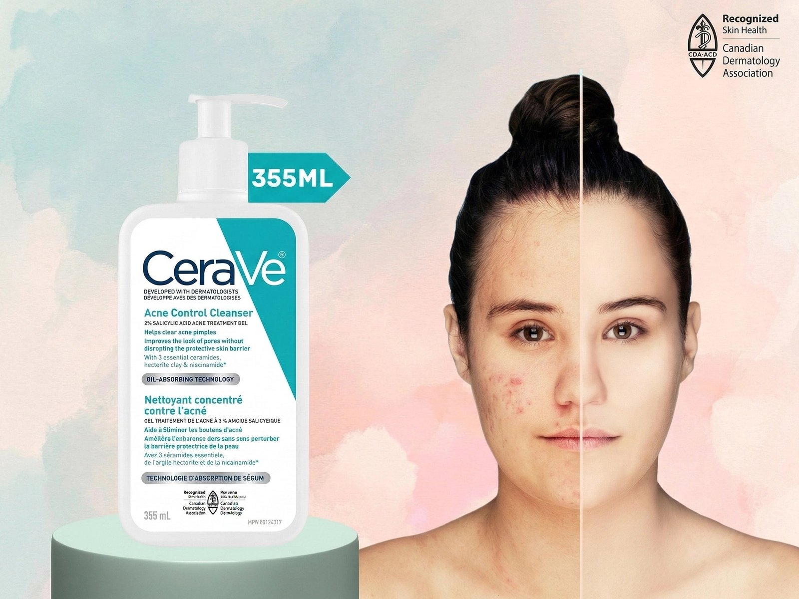 Cerave Acne Control Cleanser 355ml - Image 4
