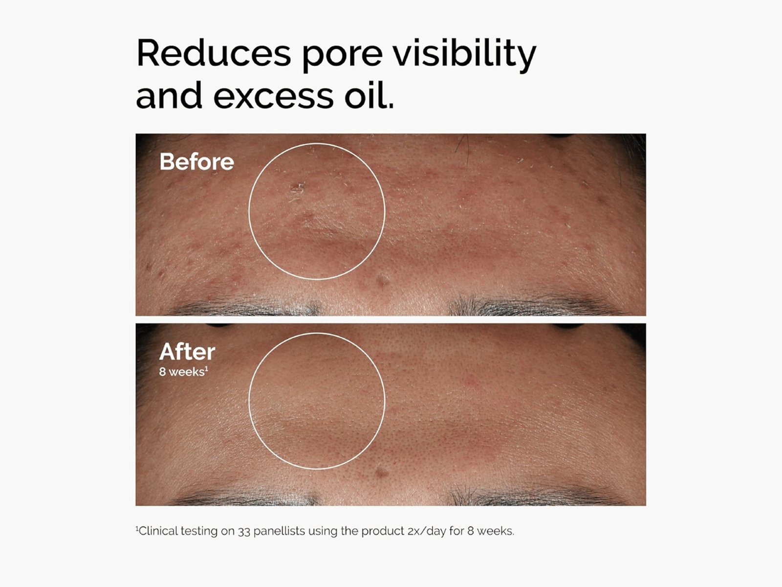 The Ordinary Niacinamide 10% + ZINC 1% 60ml - Image 3